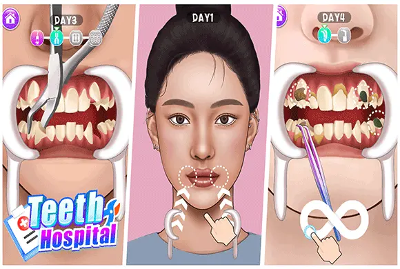 Teeth Hospital MiniGame